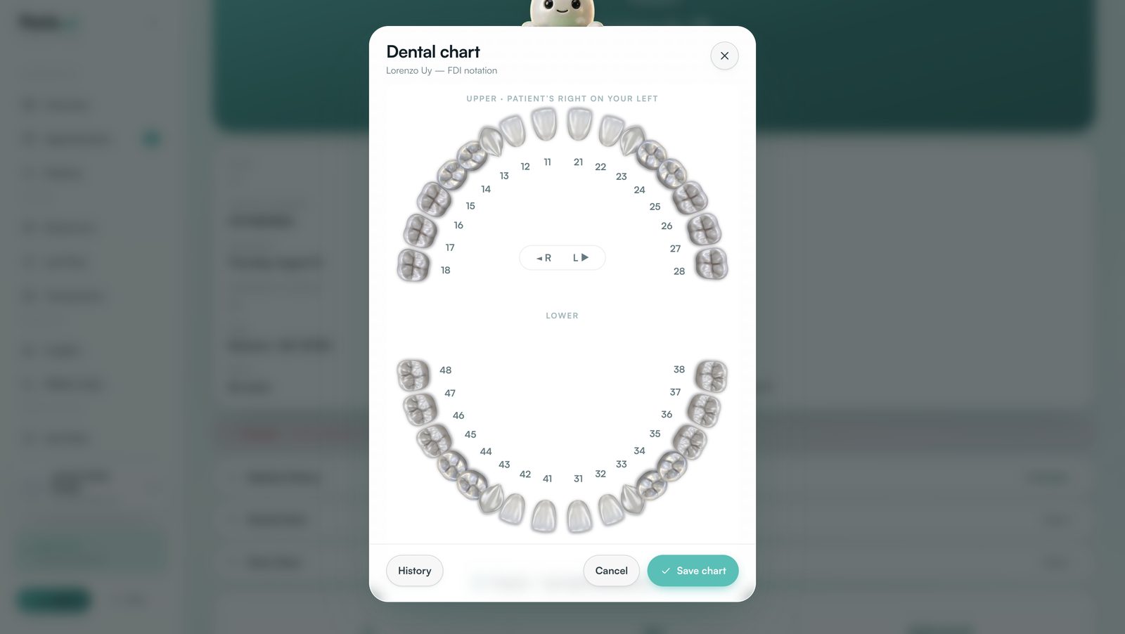 Perla dental chart, light